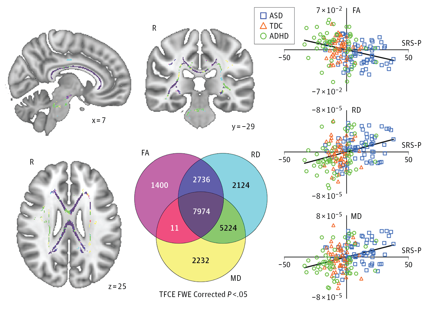 Association of White Matter Structure With Autism Spectrum ...