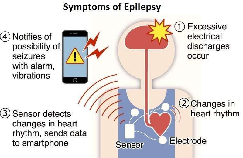 Epilepsy and busting the myths surrounding it
