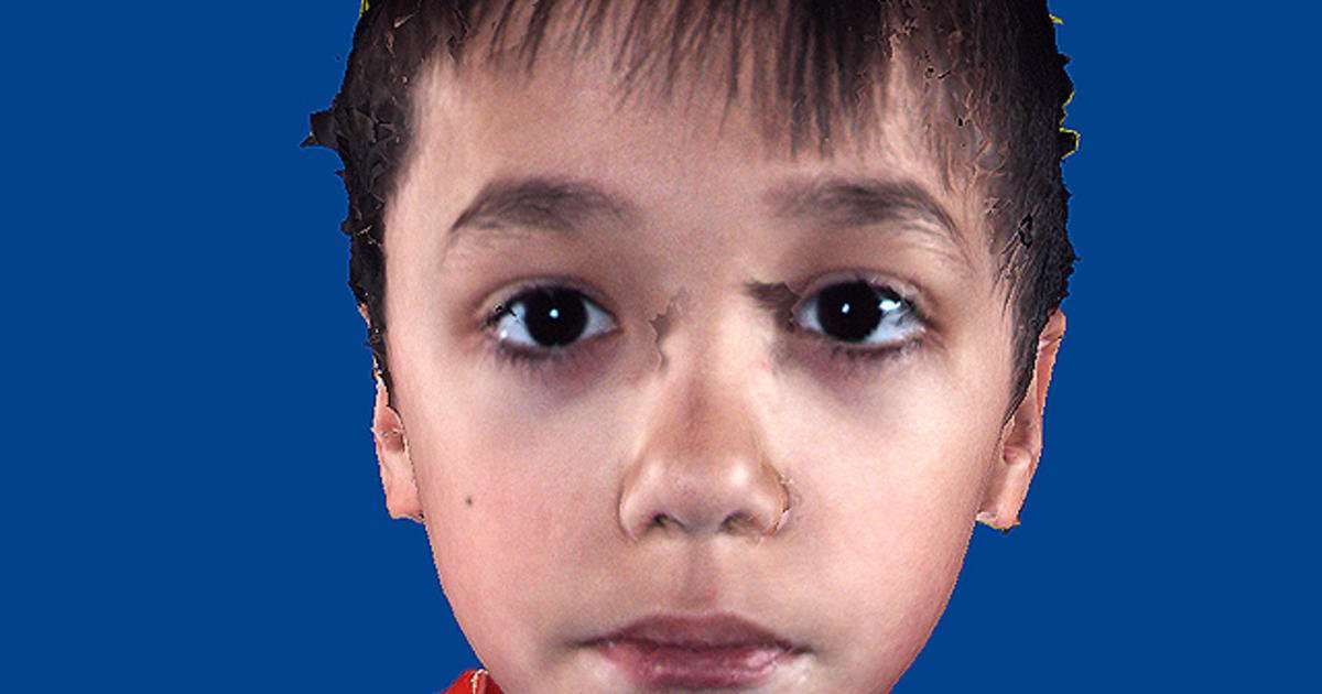 Is it autism? Facial features that show disorder