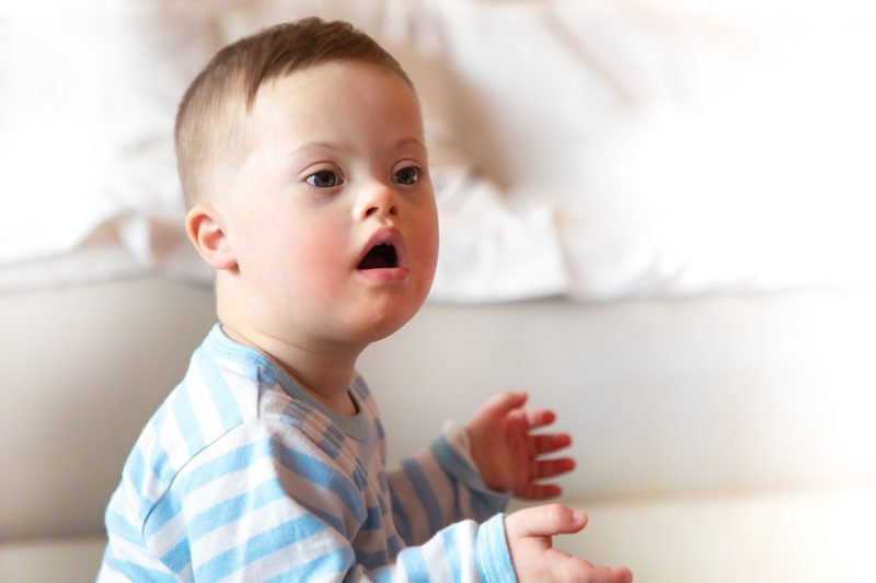 Know the Signs of a Dual Diagnosis of Down Syndrome and ...