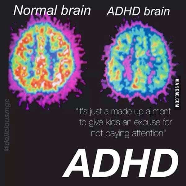 Neural reaction of a normal human brain vs human brain with ADHD under ...